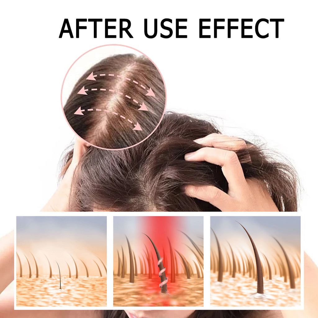 Boost Hair Serum, Prevent Hair Loss Strengthen Thicken And Nourish Hair Roots Hair Care Serum