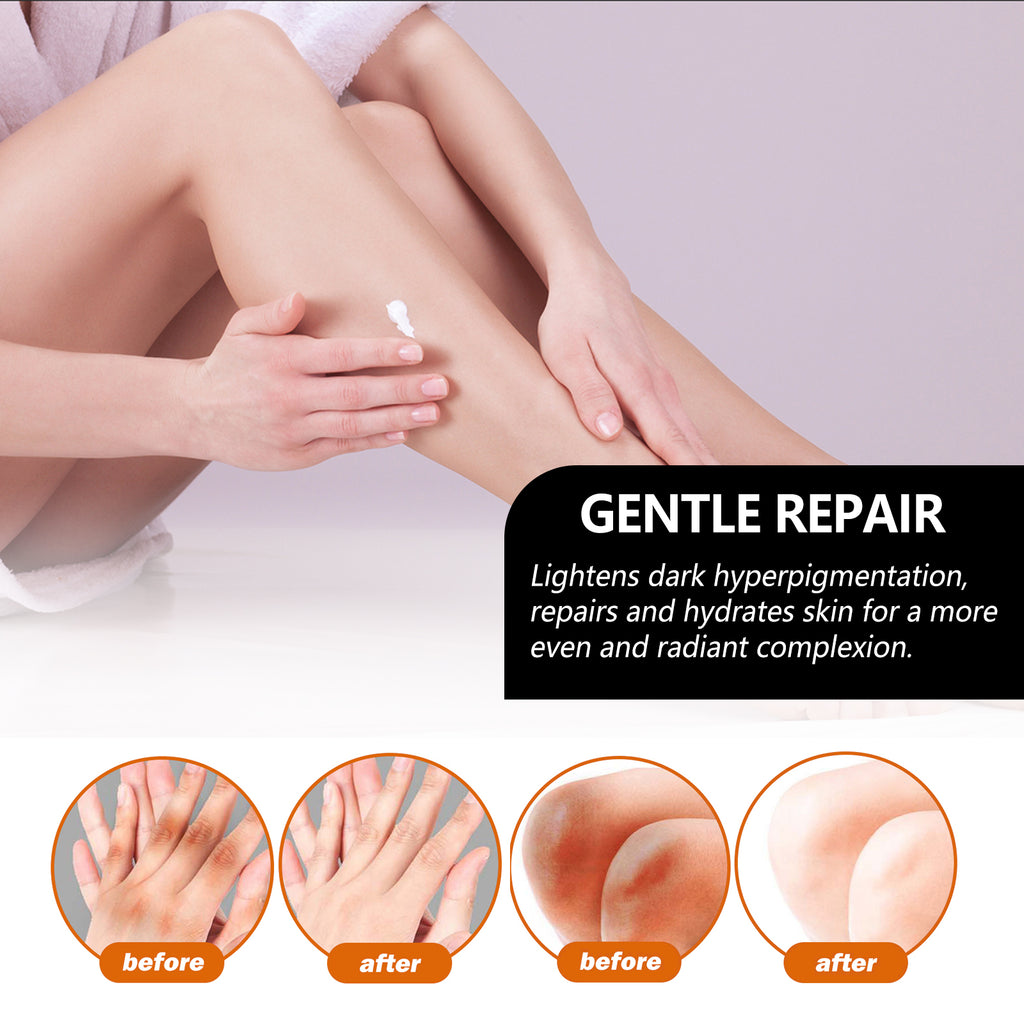Jaysuing Underarm Whitening Soap, Clean And Repair Dark Skin Acanthosis Nigricans Moisturizing Whitening Beauty Soap